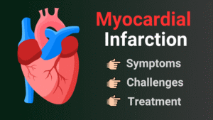 Myocardial Infarction Symptoms | Latest Treatment And Challenges